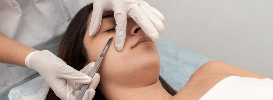 dermaplaning bristol