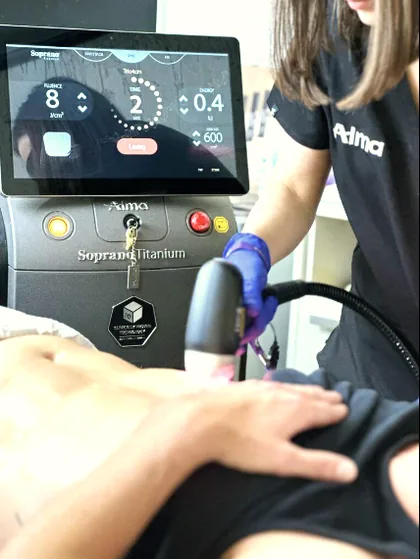 The Soprano Titanium control screen mid treatment at The Hampton Clinic