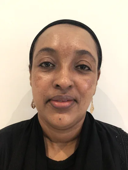 Patchy pigmentation across the cheeks of a female patient before treatment at The Hampton Clinic, Bristol